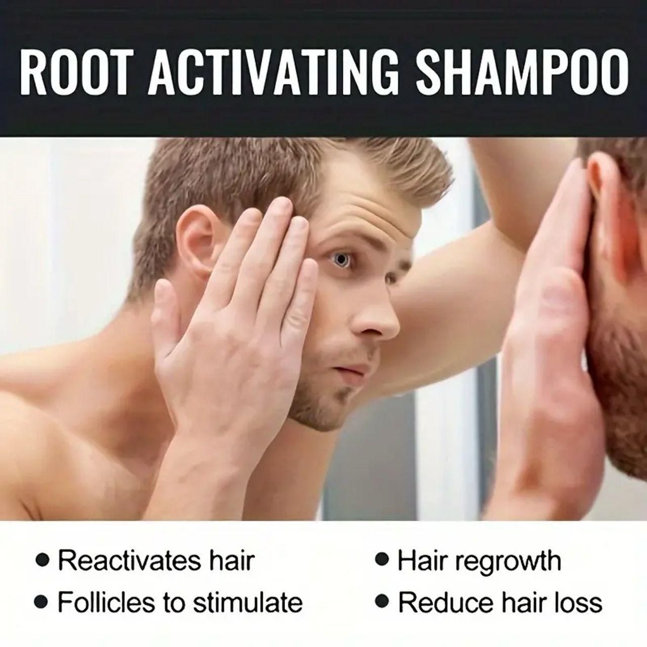 Root Activating Shampoo 100ml (Pack of 2) – Natural Hair Growth & Strengthening Formula | SFYKARTRoot Activating Shampoo 100ml - Unleash the Power of Nature for Stronger, Healthier Hair  (Pack Of 2)