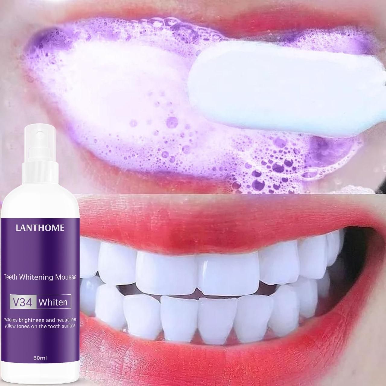 Lanthome Teeth Whitening Mousse V34 Whiten 50ml – Daily Use Tooth Foam for Stain Removal & Bright Smile (Pack of 1/2) | SFYKART