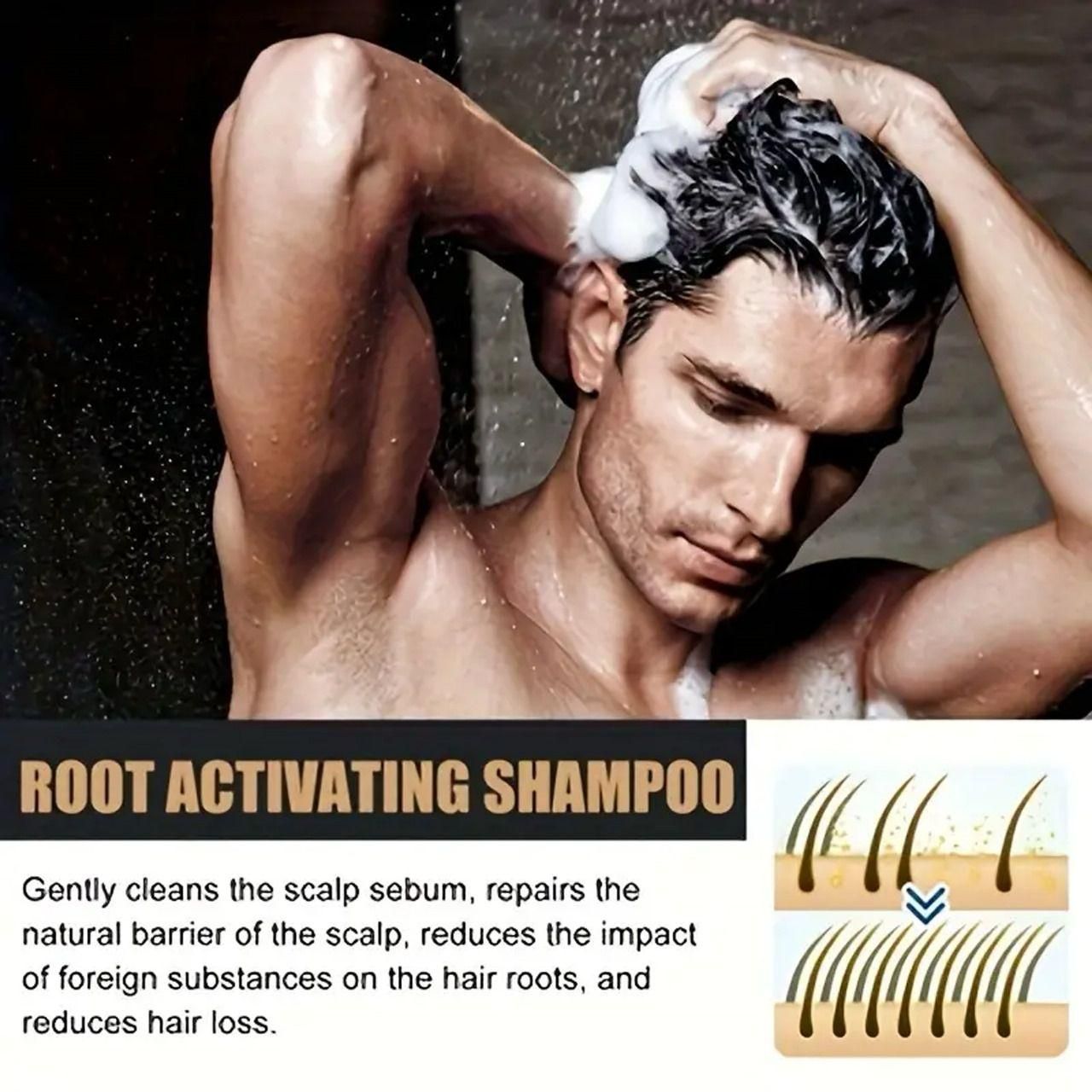 Root Activating Shampoo 100ml (Pack of 2) – Natural Hair Growth & Strengthening Formula | SFYKARTRoot Activating Shampoo 100ml - Unleash the Power of Nature for Stronger, Healthier Hair  (Pack Of 2)