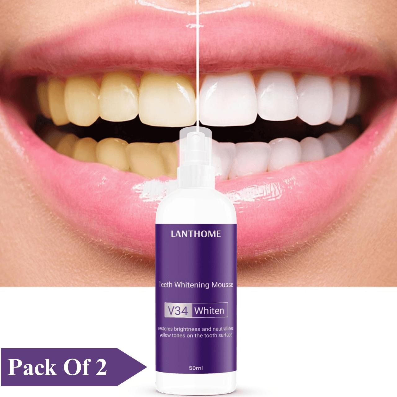 Lanthome Teeth Whitening Mousse V34 Whiten 50ml – Daily Use Tooth Foam for Stain Removal & Bright Smile (Pack of 1/2) | SFYKART