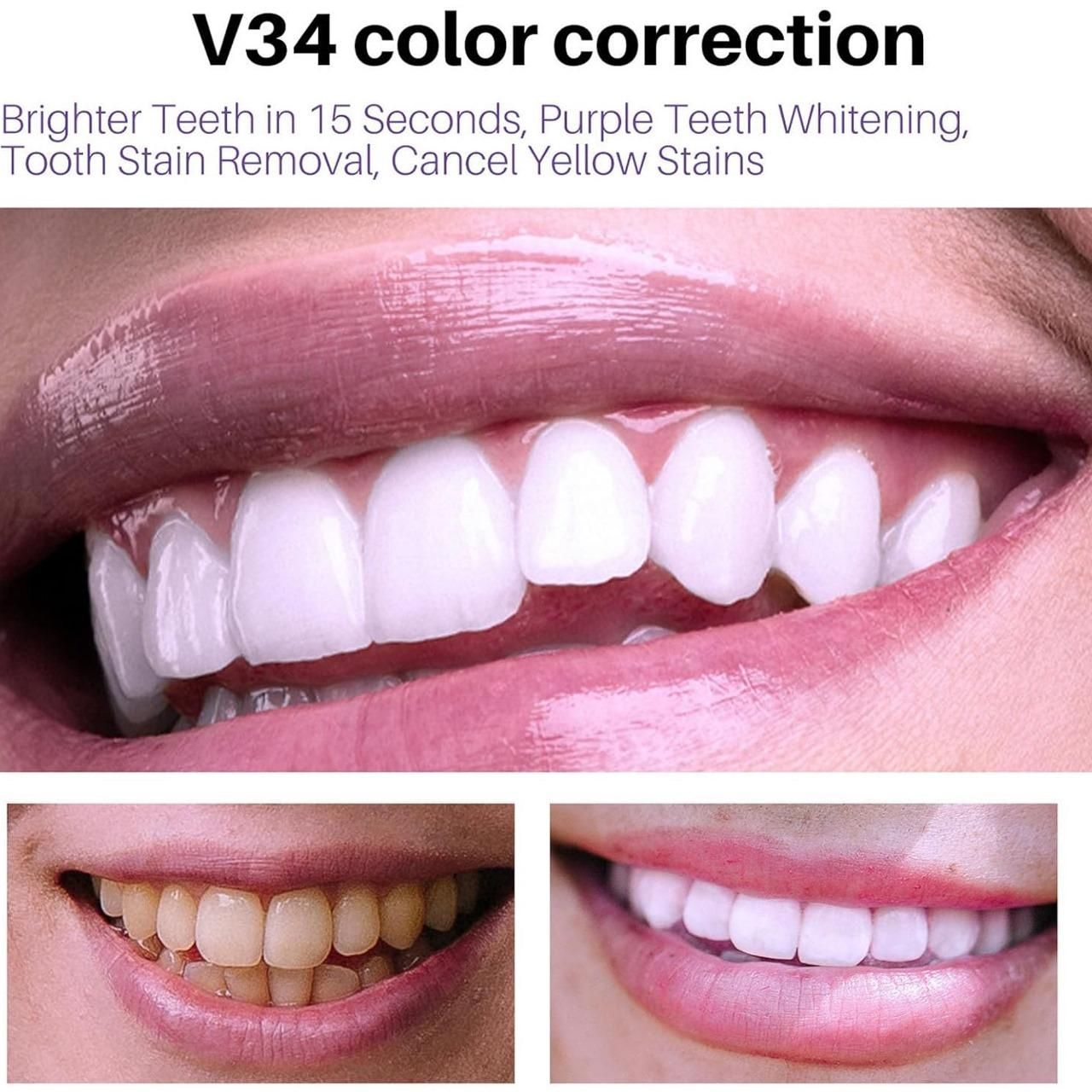 Lanthome Teeth Whitening Mousse V34 Whiten 50ml – Daily Use Tooth Foam for Stain Removal & Bright Smile (Pack of 1/2) | SFYKART